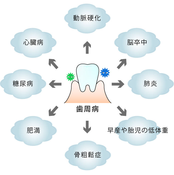 歯周病と全身疾患の関係